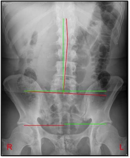 x-ray example